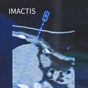 IMACTIS